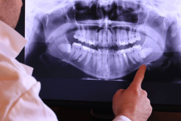 Best Weekend Emergency Dentist in Windsor, IL